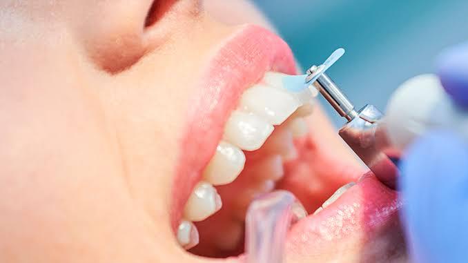 Limpeza dental