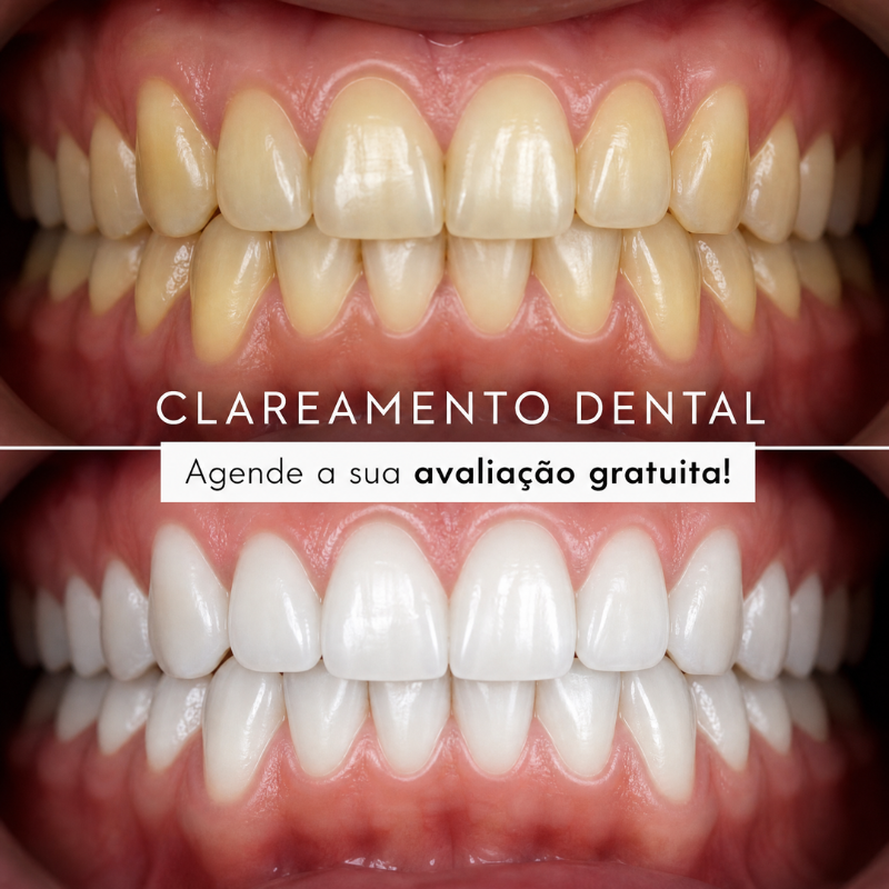 CLAREAMENTO