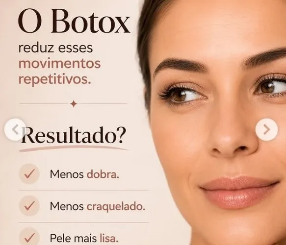 Botox 02